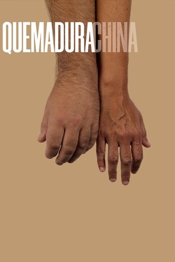 Poster of Quemadura china