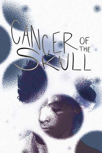 Poster of Cancer of the Skull