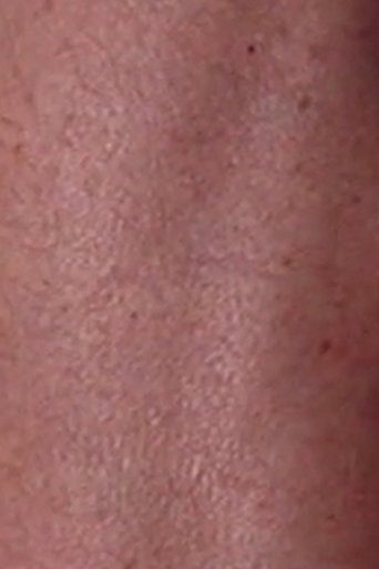 Suite: My Father's Leg Poster of Suite: My Father's Leg