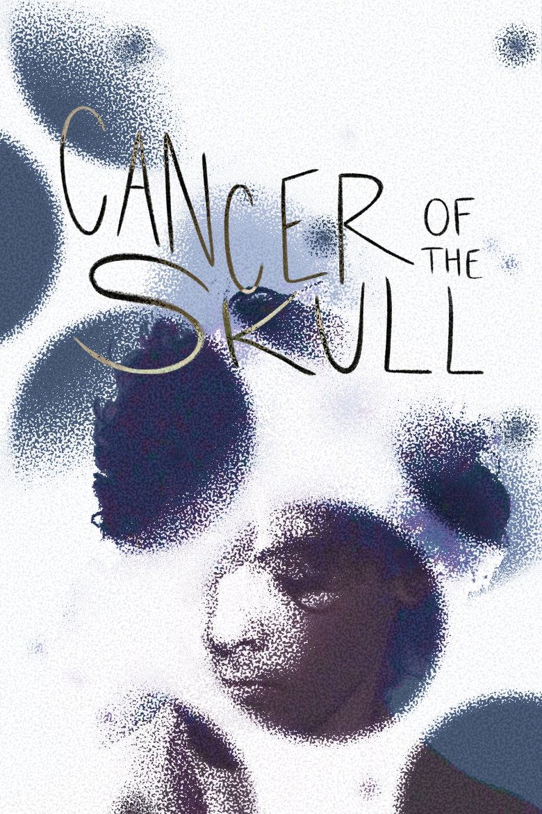 Poster of Cancer of the Skull