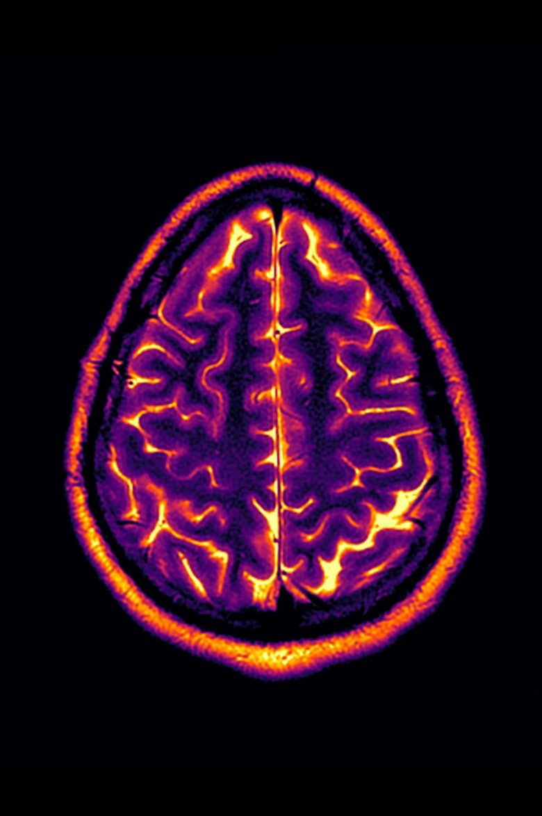 Poster of Conclusion: Stable Disease
