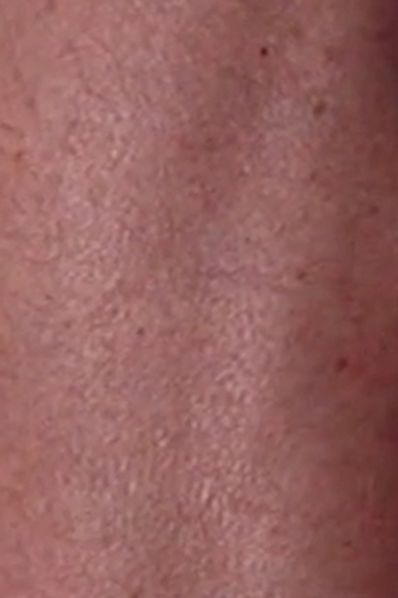 Poster of Suite: My Father's Leg